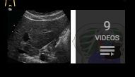 better-ultrasound-you-tube-2.jpg